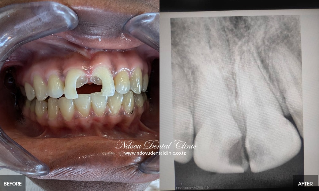 before & After--09