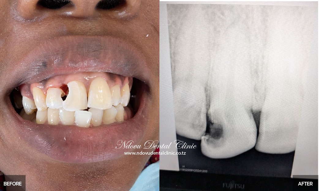 before & After-09